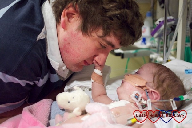 Baby Jessica in intensive care, stroking Daddy's face