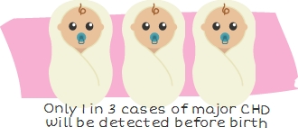 Only 1 in 3 major cases of CHD will be detected before birth - Two Important Ways to Give Your Baby's Heart a Better Start - a guest post from Aimee Foster - Little Hearts, Big Love