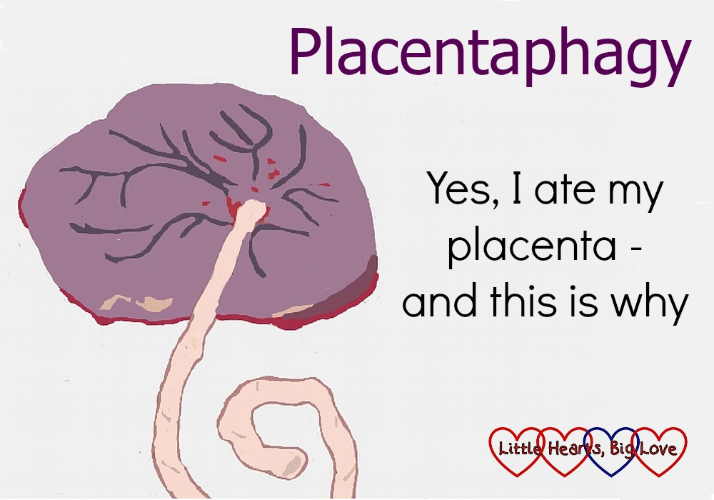 A drawing of a placenta. "Placentaphagy - yes, I ate my placenta and this is why"