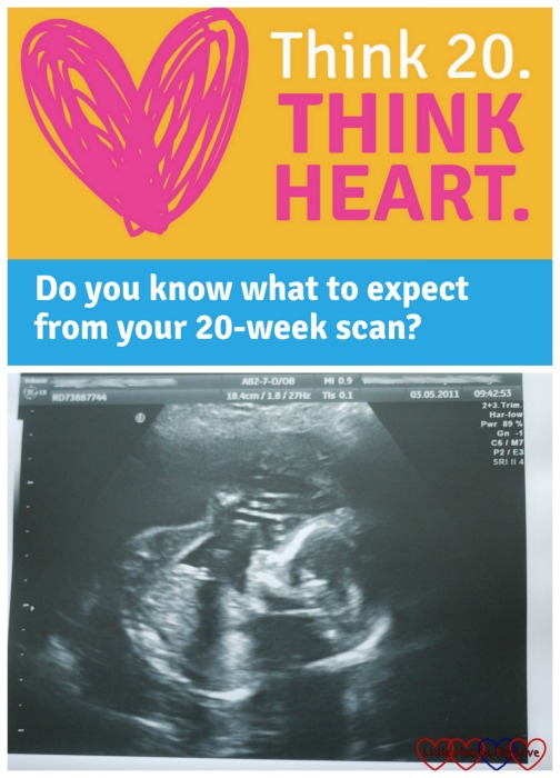 Think 20. Think Heart - why the 20-week scan is so important for helping to detect congenital heart defects