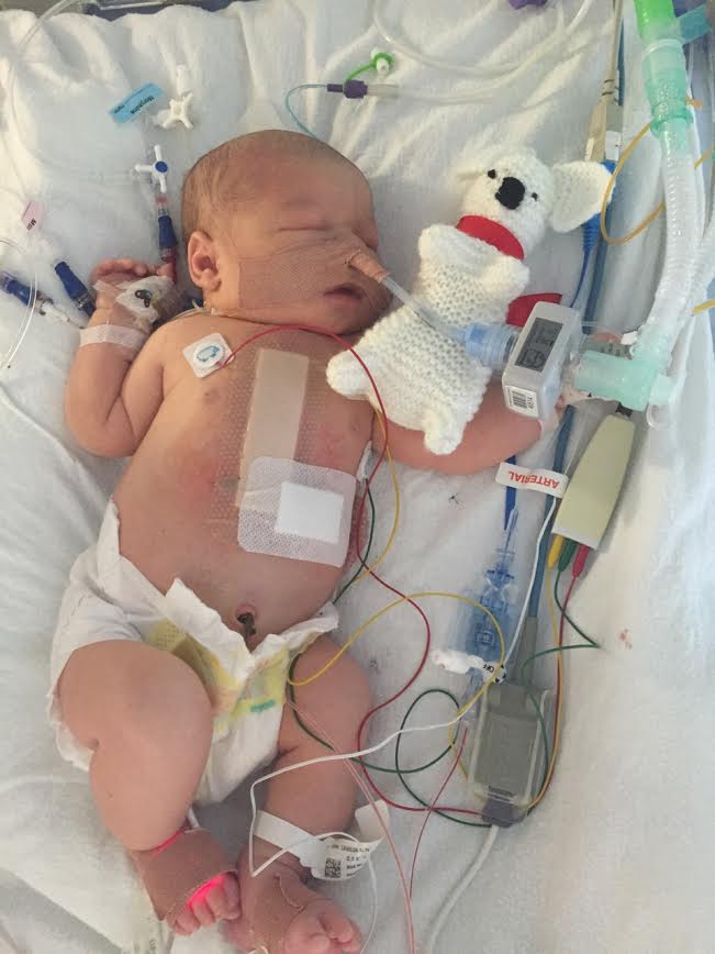 Baby Arthur recovering from heart surgery