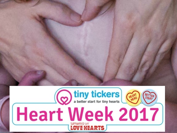 Hands forming a heart over a "zipper scar" with the logo for Tiny Tickers Heart Week 2017