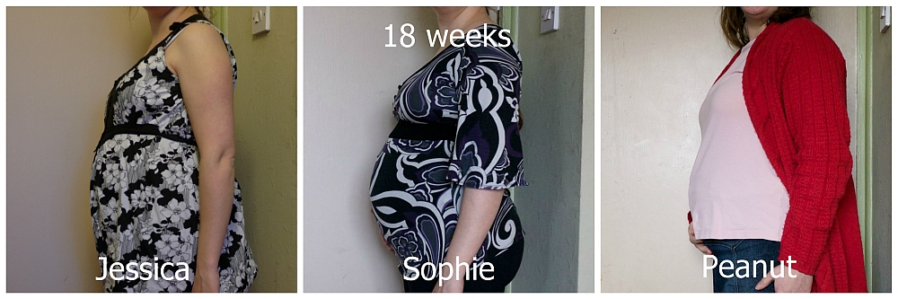 Three photos showing my bump at 18 weeks with Jessica, Sophie and Peanut