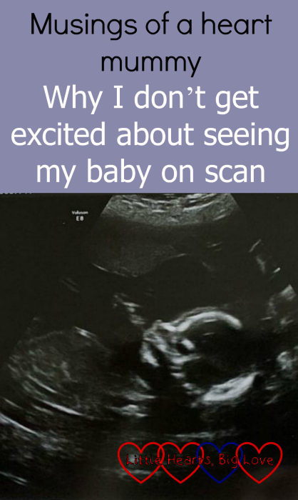 A 20-week scan picture - "Musings of a heart mummy: why I don’t get excited about seeing my baby on scan"